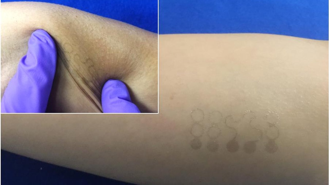These temporary graphene &#8216;tattoos&#8217; could help track your vital signs