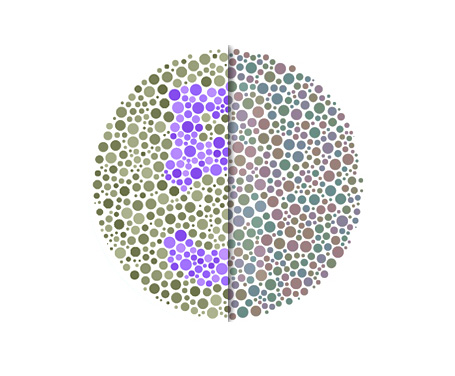 A person with red-green colour-blindness sees the world differently. Their red and green photopigments have more overlap than normal, making them unable to see certain colours. This Ishihara test simulates how colours may appear to a colourblind person.
Source: Youtube/CNBC