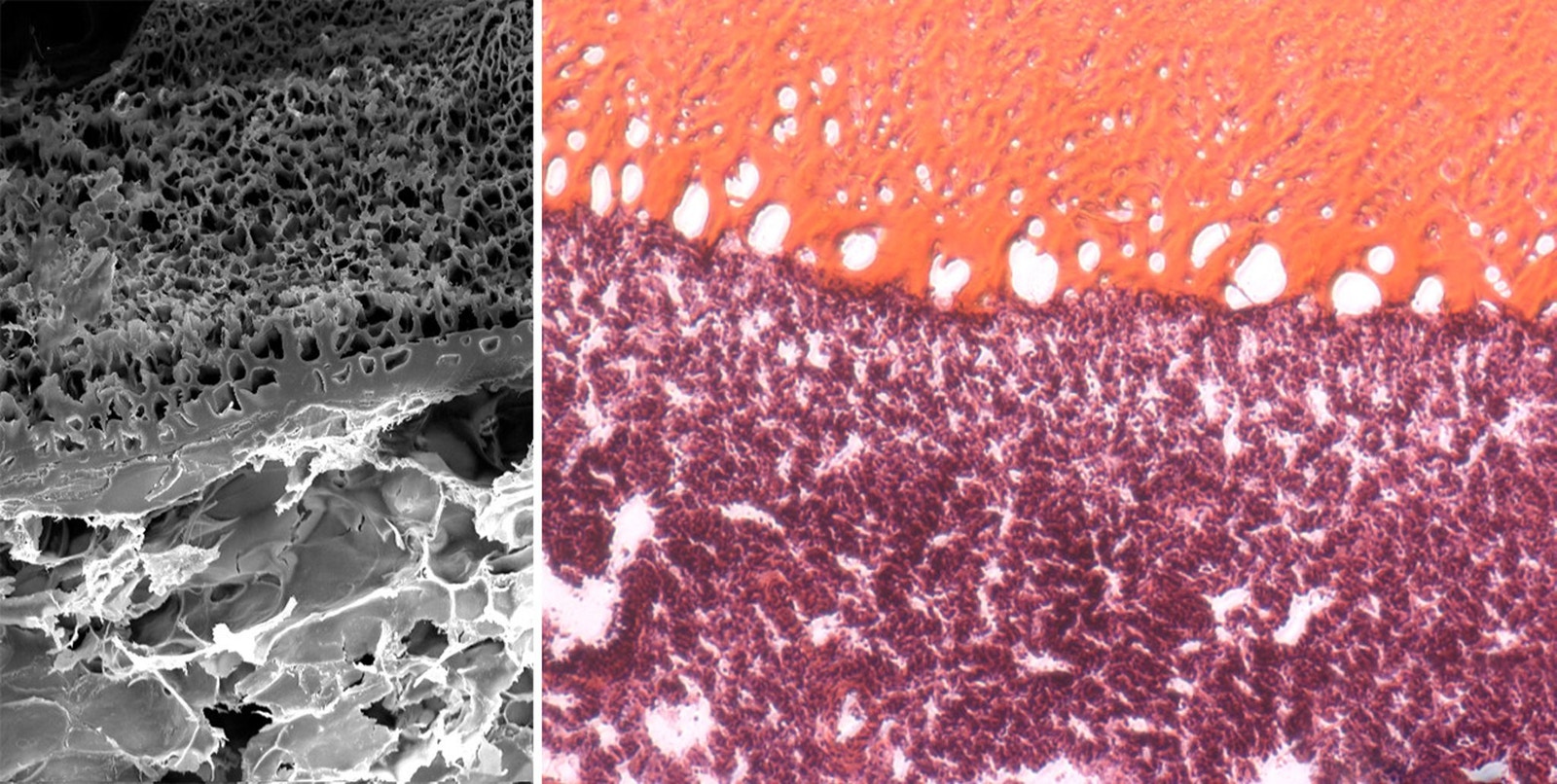 both showing how MeTro gel (on top), applied to an injured lung area, bonds and interlocks with the tissue surface. The elastic tissue is tightly sealed without the need for additional sutures or staples. Credit: Wyss Institute at Harvard University