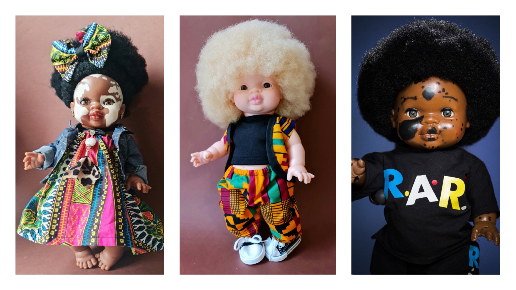 Skin pigmentation condition, or other  limitations are a speciality — ”Selah” is one of the dolls with vitiligo. ”Zavayo” is one of the dolls with albinism. “Christopher” has Nevus. Original handmade customised dolls with differend skinconditions to bring diversity into children's lives.