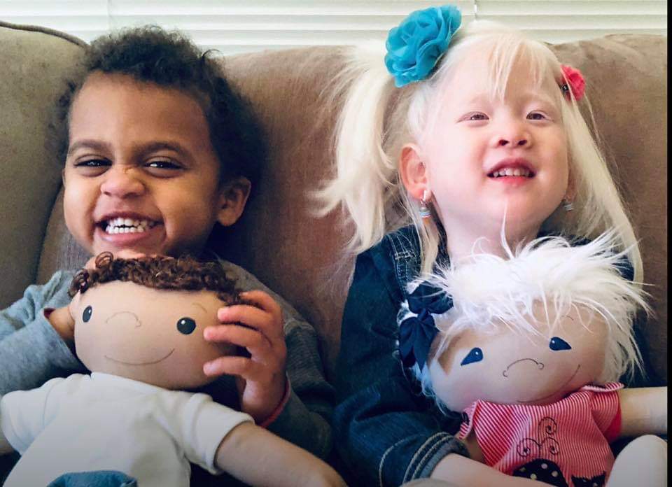 Dolls with albinism, dolls with prosthetic legs and feeding buttons, dolls with birthmarks and scars, dolls with burn scars that match those of their owner.