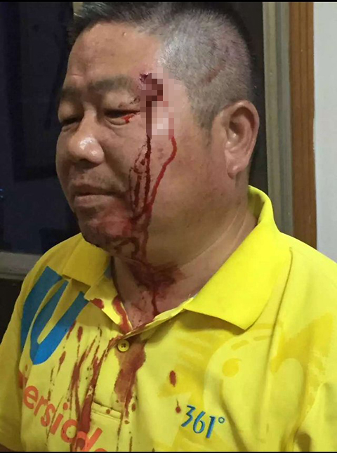 Chen Si’s compassion is not without its own hazards. He has been attacked more than once over the years by people who he was trying to save.
