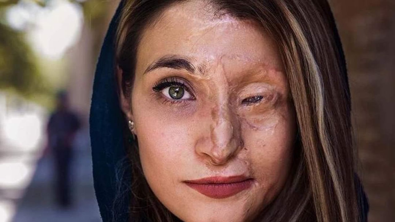 El rostro de la valentía, fuerza y belleza: Marzieh Ebrahimi
