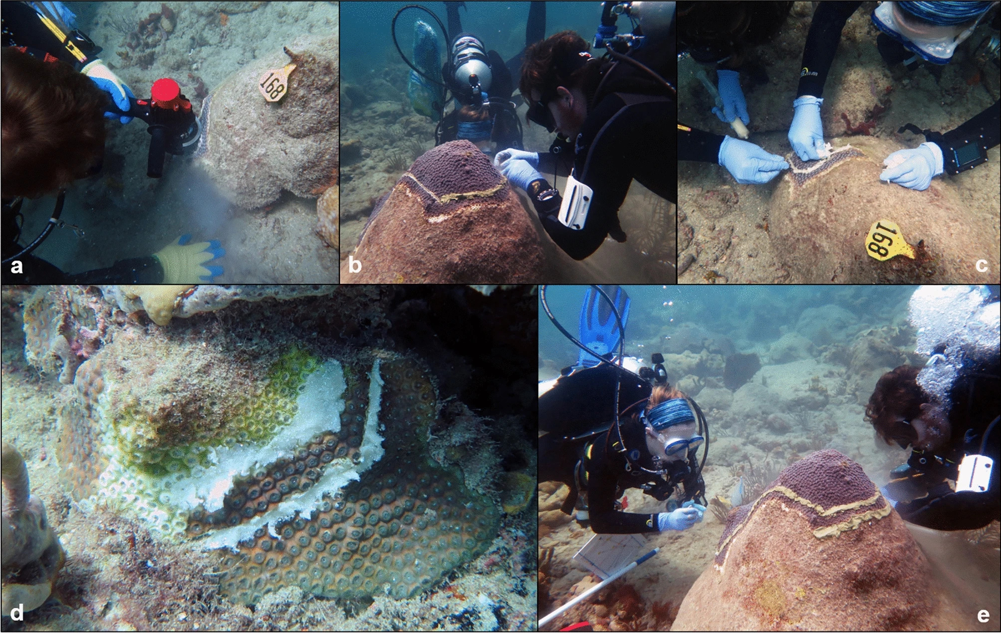 (a) Diver creating a trench around the SCTLD lesion using an angle grinder. (b) Filling a trench with the chlorinated epoxy treatment. (c) Filling a trench with the Base 2B plus amoxicillin mixture. (d) A SCTLD-affected coral colony that has been treated with the Base 2B plus amoxicillin mixture. (e) A SCTLD-affected coral colony partially treated with the chlorinated epoxy.