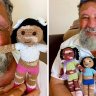 This grandfather with vitiligo crochets dolls for children with the same skin condition