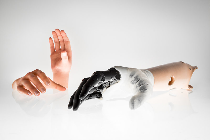 It is uniquely similar to a human hand, and being developed directly with patients, has immediate practical use.