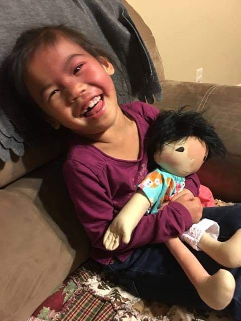 Birthmarks, Bell’s palsy, cleft palate, operation scars, you name it, Amy will lovingly recreate it in a cute and cuddly doll to bring a smile to the face of of a another child who deserves to see themselves represented in their toys.