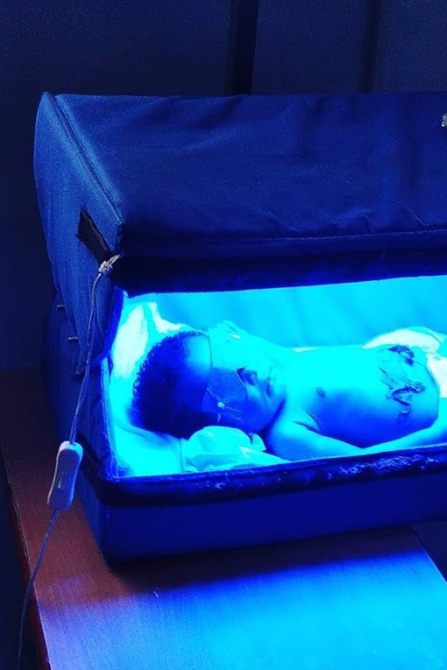 The Crib A' glow phototherapy unit is very effective for neonatal jaundice treatment because it does not have after-effects like skin burns, rashes and dehydration on the baby due to LEDS light component in it.