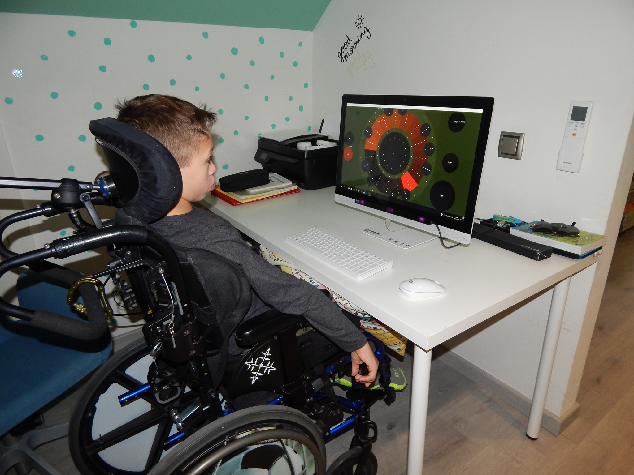 It’s set up to accommodate those suffering from cerebral palsy, amyotrophic lateral sclerosis, muscular dystrophy, amputation of an upper limb, or spinal cord injury by letting them use their eyes or head movements to control a colour wheel coded with chords to play music. To use the EyeHarp, musicians simply have to install the software and an eye-tracking camera.