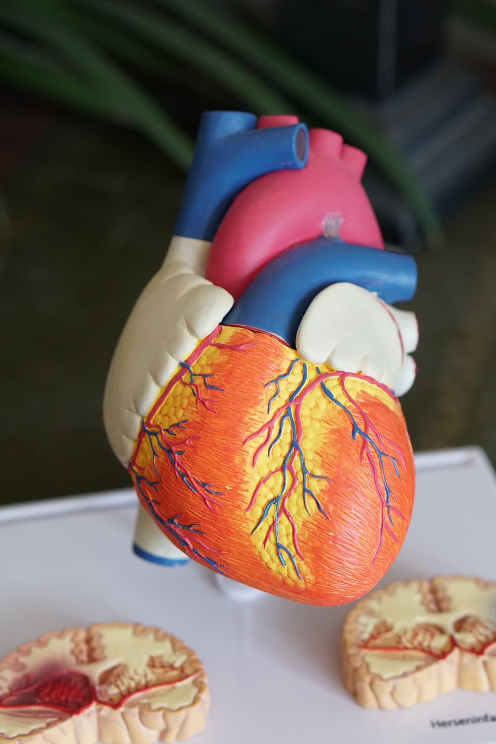 The coronary arteries that supply the heart become blocked by a build-up of fatty substances in the artery wall - reducing blood flow. The disease causes heart attack (where blood supply becomes completely blocked), can lead to heart failure (where the heart muscle becomes damaged), and is linked to a number of factors including smoking, high cholesterol, high blood pressure and diabetes.