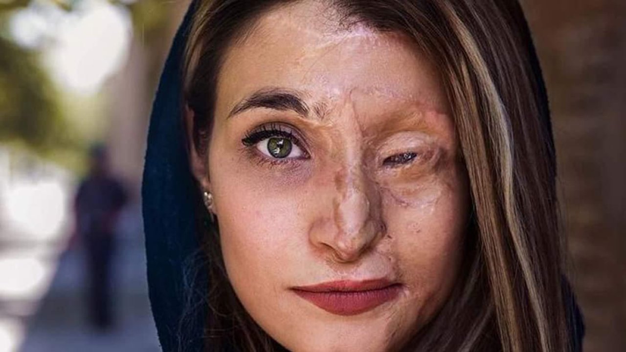 The face of courage, strength and beauty: Marzieh Ebrahimi