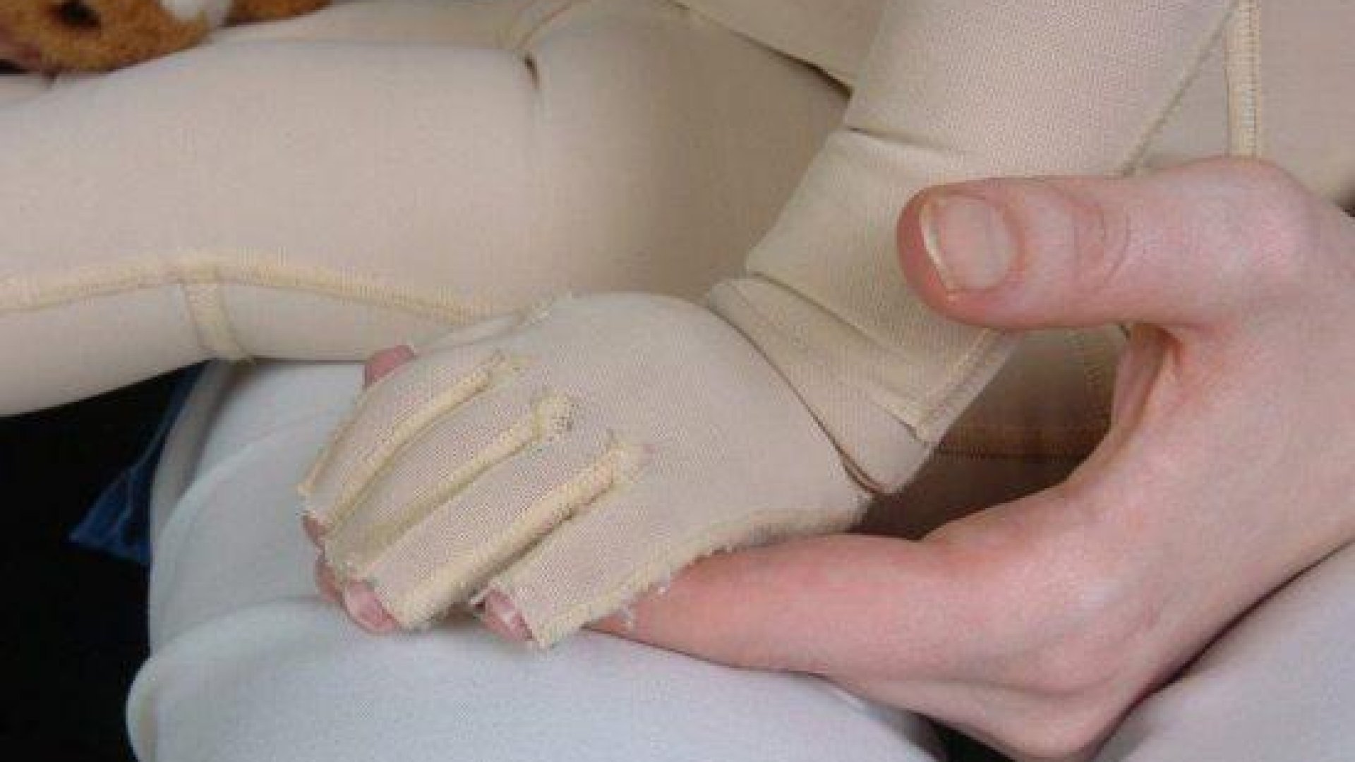 Innovative machine grows new skin for burn victims BrightVibes