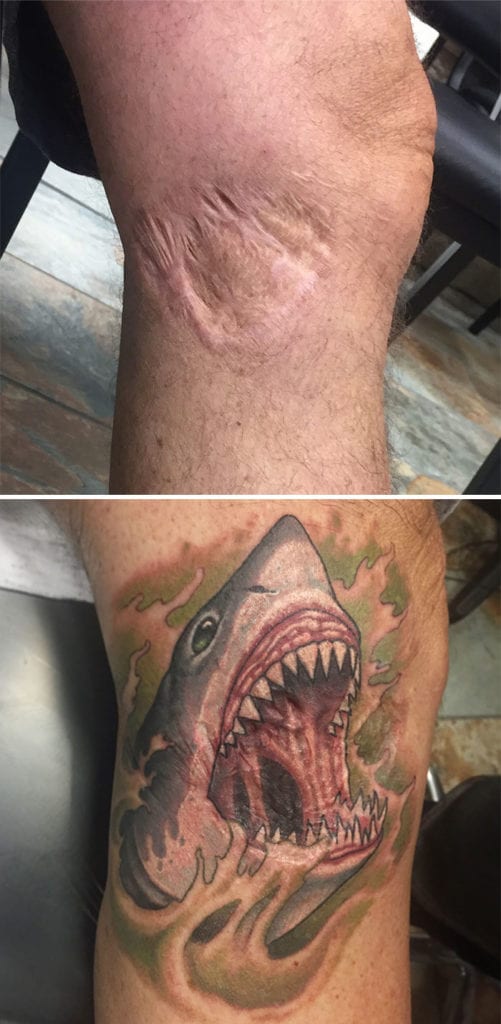 Esta persona convirtió una experiencia desgarradora, una mordedura de tiburón, en una obra de arte. El tatuaje rinde homenaje a la razón de la cicatriz mientras que inyecta un poco de humor en lo que seguramente fue una situación muy aterradora en ese momento.